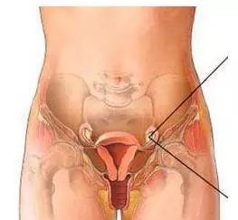 子宫淤血堆积的原因,子宫发黑暗示什么