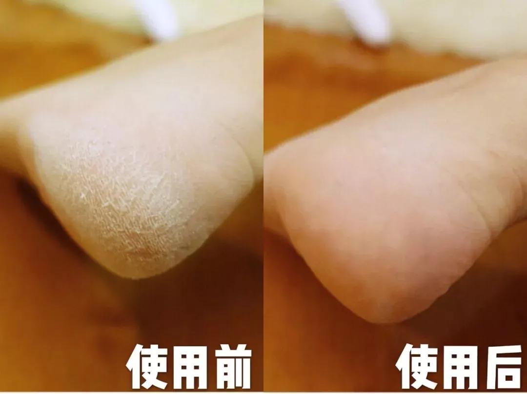 坚持涂身体乳还是很干,坚持涂身体乳二十年