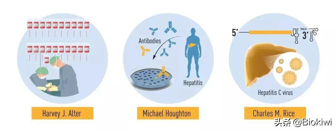 丙肝没病毒了还需要治疗吗,没有病毒的丙肝能传染吗