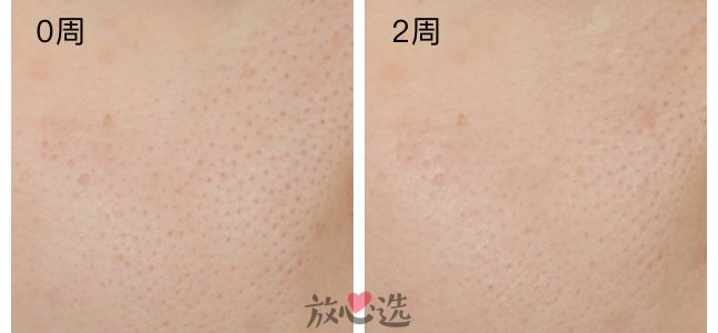 好用的毛孔收敛产品,收敛水收缩毛孔推荐真实