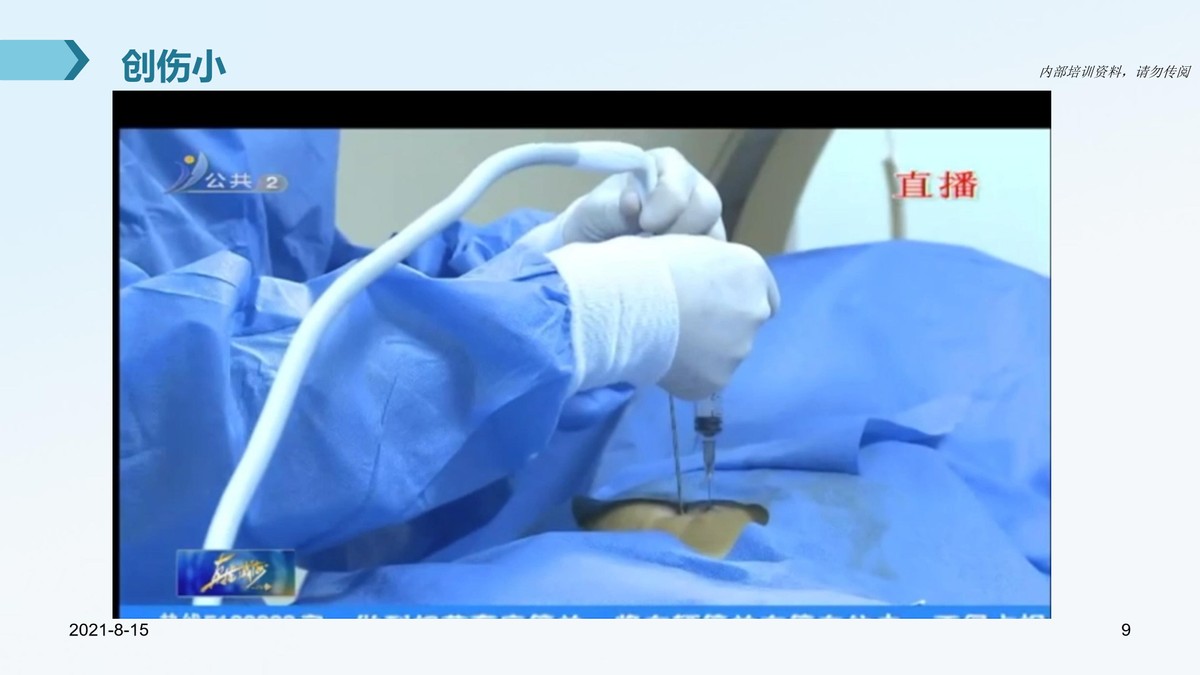 氩氦刀治疗肿瘤的医院,氩氦刀治疗肿瘤范围多大