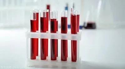 血淀粉酶和尿淀粉酶哪个先升高,血淀粉酶升高一定是胰腺炎吗