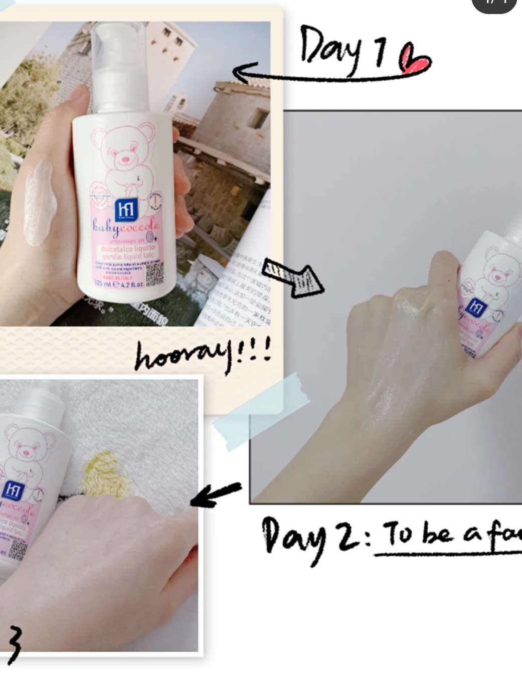 宝宝手指变异什么原因,宝宝手像猪蹄