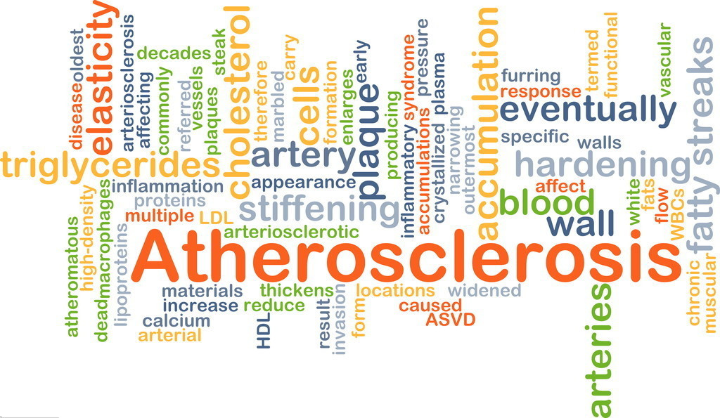 胆固醇高和动脉硬化有关系吗,动脉硬化是因为胆固醇过高