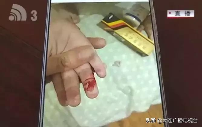 孩子在幼儿园被烫伤赔偿800万,小孩店里玩耍被烫伤谁担责