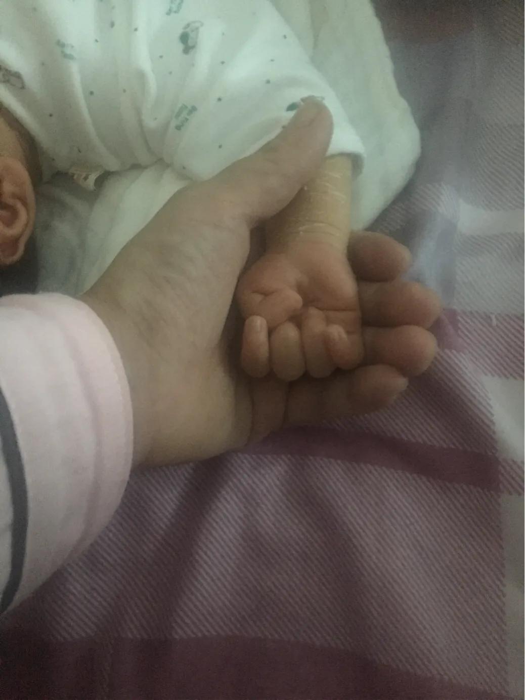 宝宝的手大拇指内弯,宝宝的拇指都是向着掌心的吗