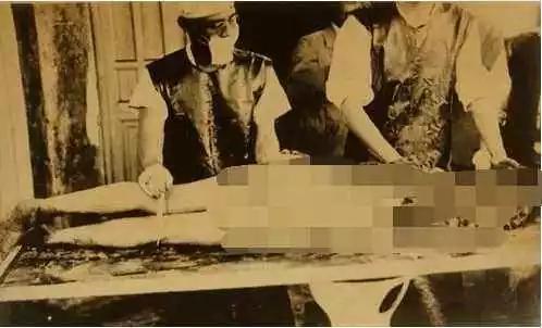 731瀹為獙瀹ゆ爣鏈摱閲岀殑鍐呰剰鍥剧墖,鏃ユ湰鑰佸叺璁茶堪731瑙ｅ墫灏镐綋