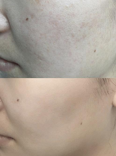 给肌肤做清洁搓出死皮，紧致毛孔白嫩肌肤，网友：卸妆伴侣