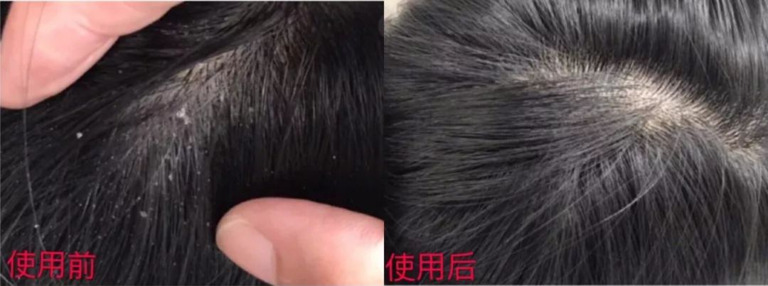 明星亲测力推同款洗发水,康王亲测