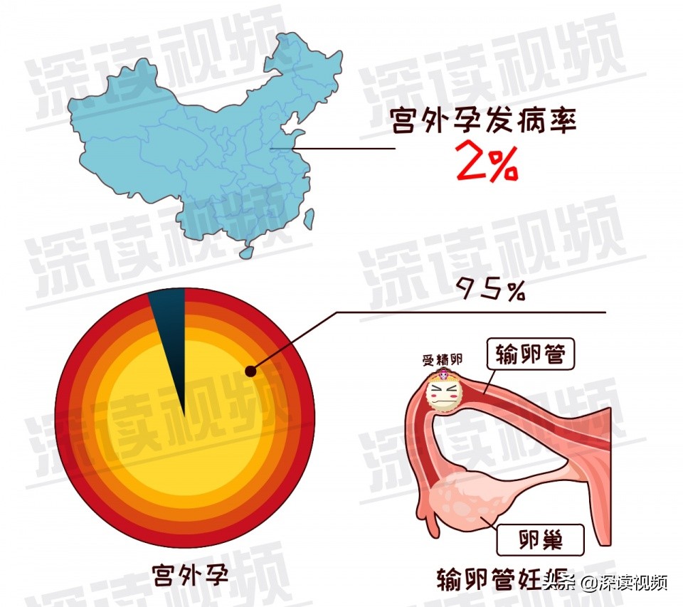 安以轩开刀保命实因宫外孕?受精卵去哪了?竟让孕妈流产大出血?
