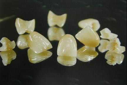 假牙价格一览表图片,假牙种类及价格表图片