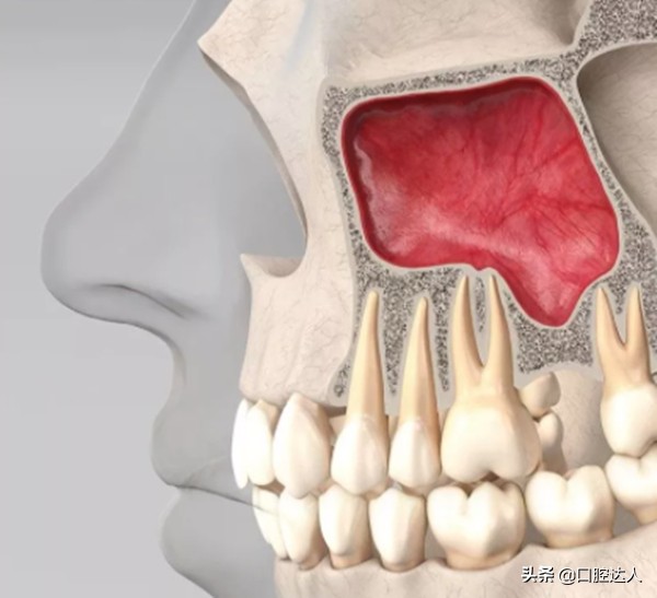 种不了种植牙还有其它办法吗,一直犹豫种牙还是镶牙