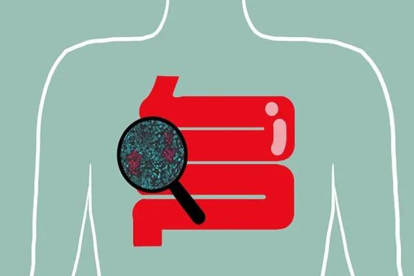 拉肚子一年多了反反复复是癌吗,反反复复拉肚子也不疼