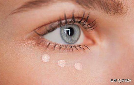 马应龙八宝眼袋霜能消除眼袋吗,有眼袋但眼袋内没脂肪怎么去除