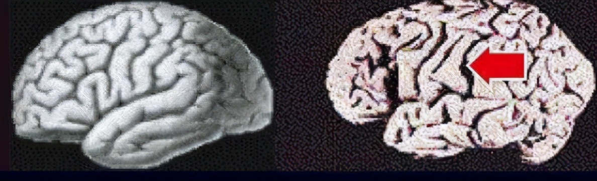 洪兰大脑,洪兰教授男女大脑思维差异完整版