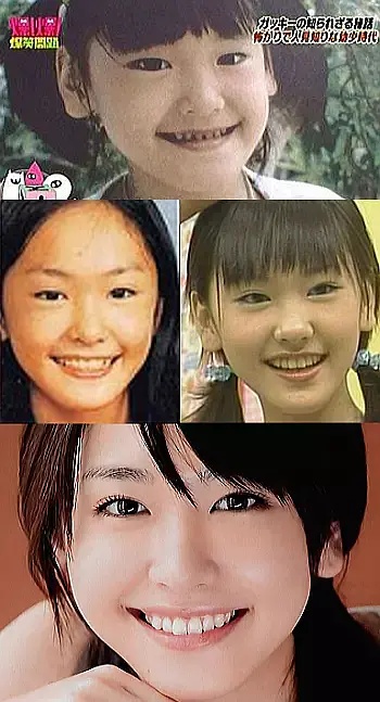 日本整容的鬼斧神工，来见识一下各位日星是整容了还是“长开”了