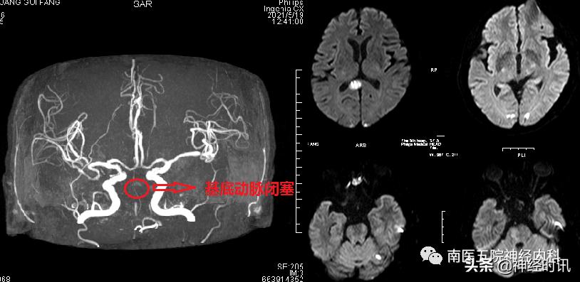 经常头晕不要以为是小问题,不能忽视的短暂头晕
