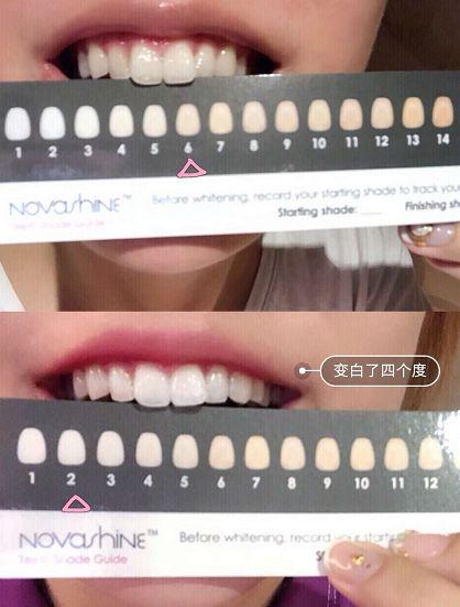 李佳琦一月变白秘籍,李佳琦的正确刷牙方法视频