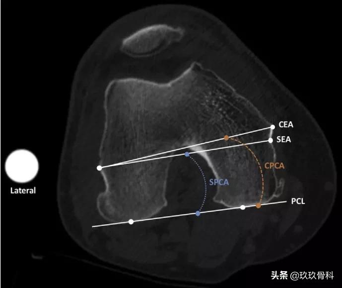 髋膝关节文献精译荟萃