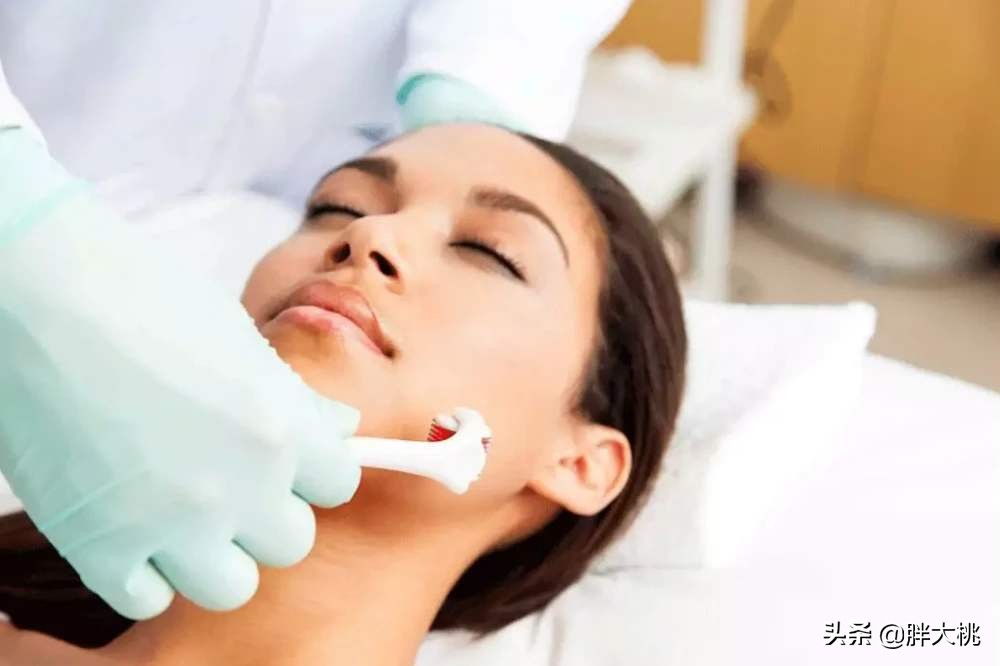 黑头闭口刷水杨酸好还是果酸好,毛孔黑头闭口怎么刷酸