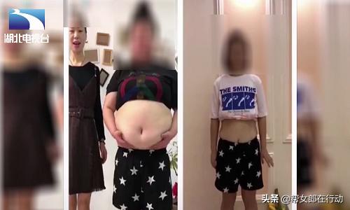 天然无副作用？女大学生“海淘”*肥药减**，四天后心脏衰竭