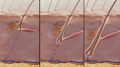 沙宣洗发水掉头发,沙宣洗发水洗了脱发