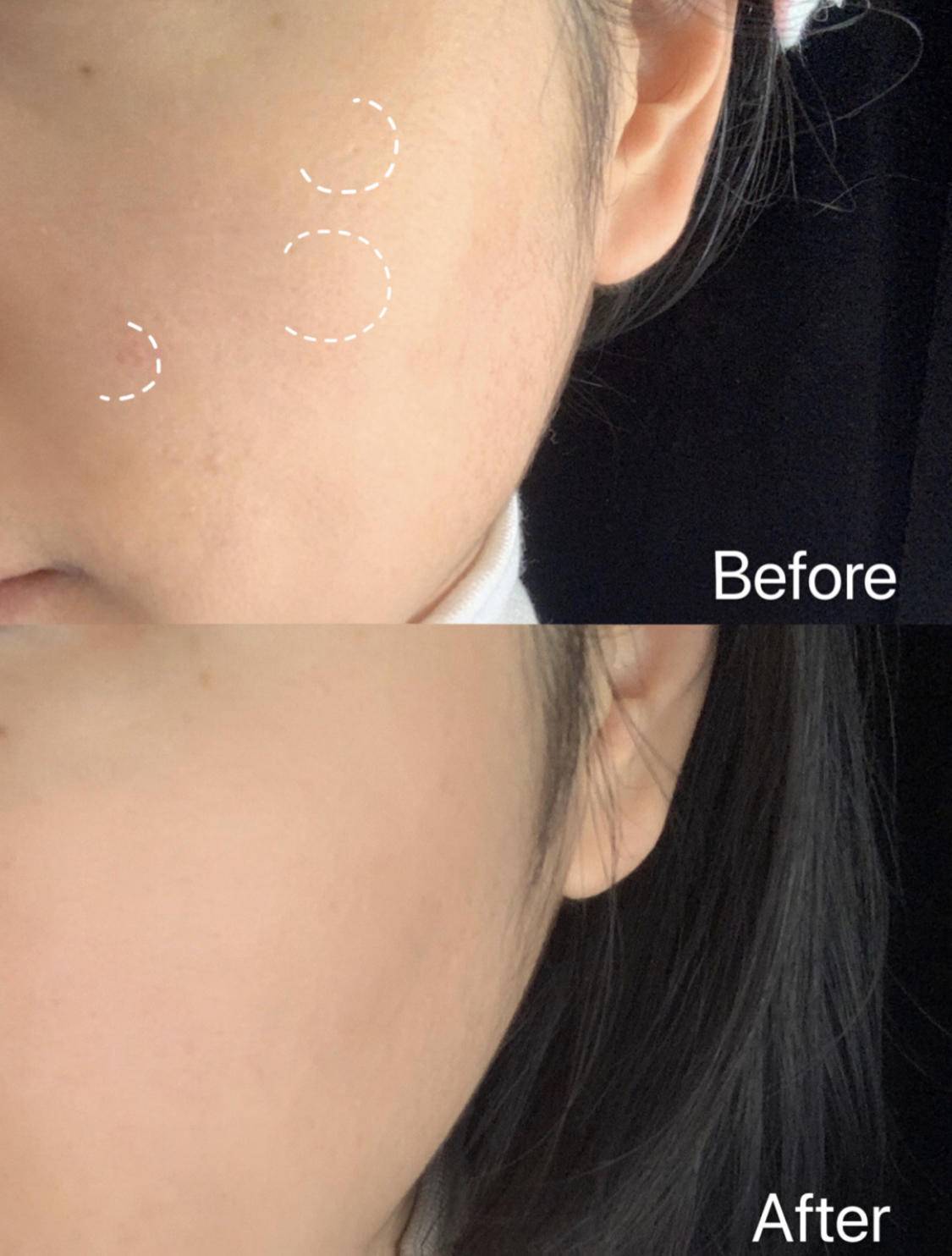 ps去雀斑最有效的小妙招,ps祛雀斑的最佳方法