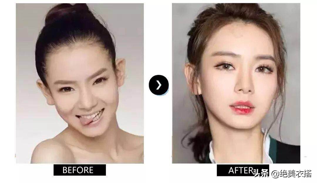 有什么办法改善面部颧骨,颧骨太大可以怎么改善颜值