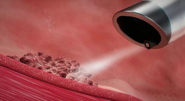 肝癌止疼一次打两针可以吗,肝癌晚期一针见效