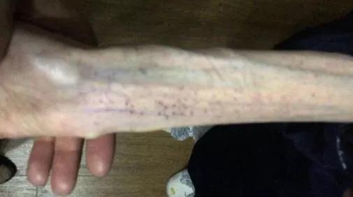 那些被自杀式减肥毁掉的中国女性