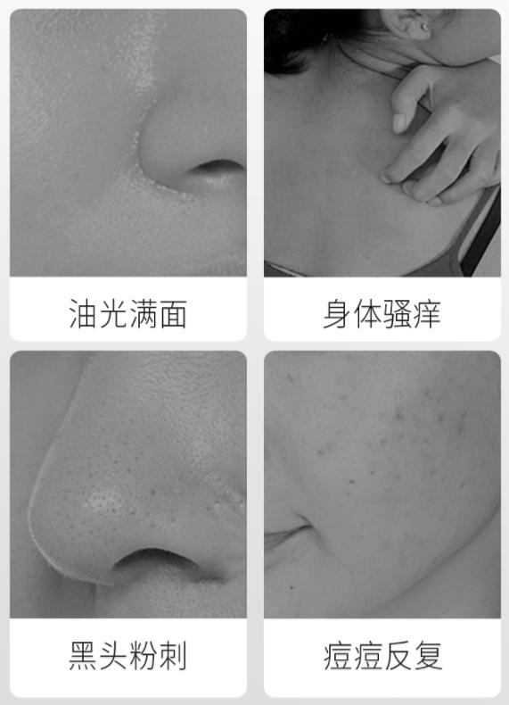 别再乱用清洁面膜了,如何正确洗脸既能白还能长痘