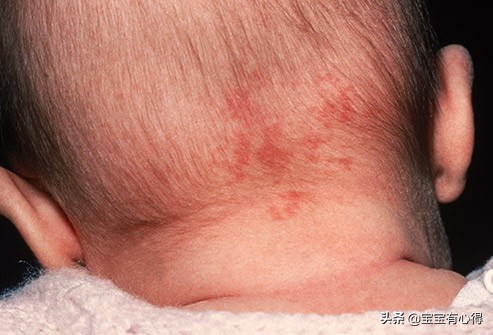 新生儿出现这十件奇怪的事情，新手妈妈要正确认识