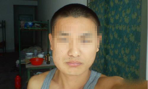 吃槟榔对身体造成什么严重的后果,吃一年槟榔脸上有什么变化