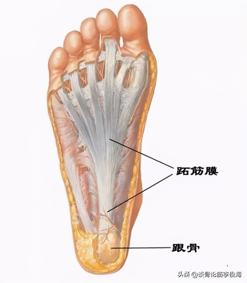 如何预防和治疗足底筋膜炎,糖尿病筋膜炎坏死怎么预防