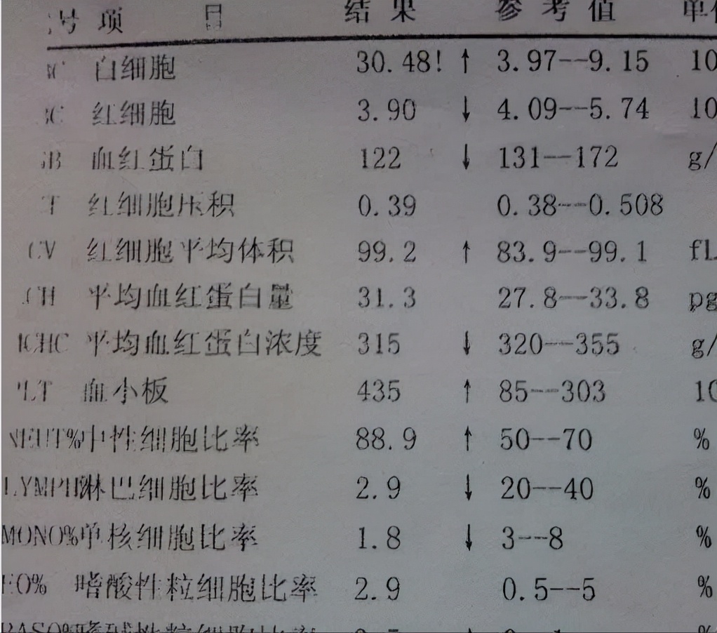 白血病需要做什么检查才能确诊,白血病确诊做什么检查