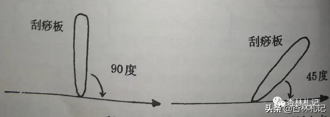 自己在家刮痧的正确方法图解,简述刮痧的操作方法