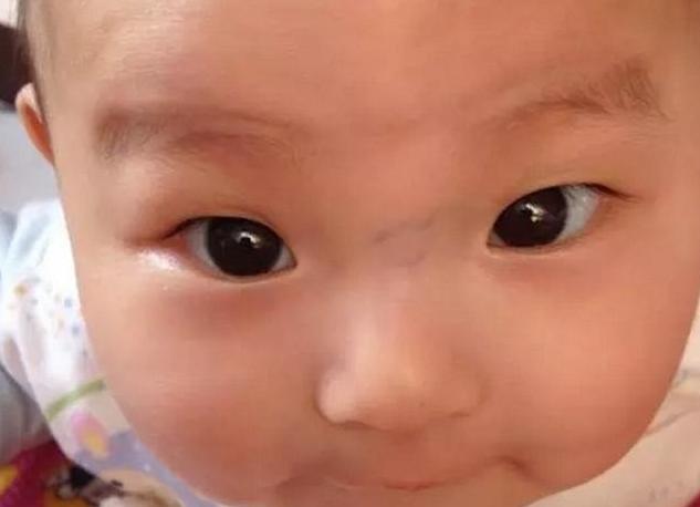 宝宝鼻子有青筋是什么原因,宝宝鼻子有青筋什么原因