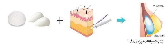 平胸丰胸最有效的方法,丰胸怎么学