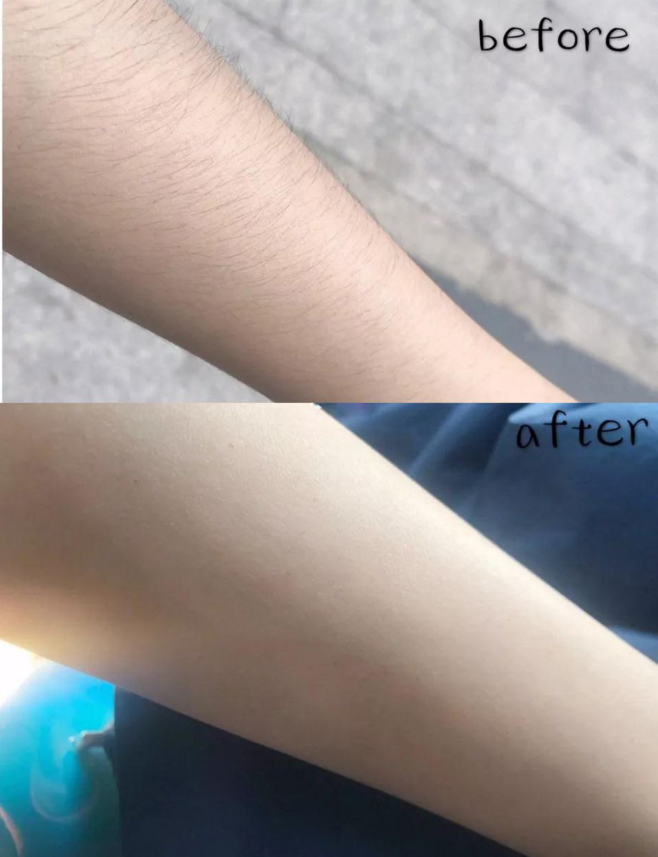 如何脱毛永远不会再长小技巧,怎么摆脱脱毛的尴尬