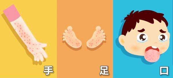 出现手足口一般什么情况需要就医,孩子得了手足口还有必要打疫苗吗