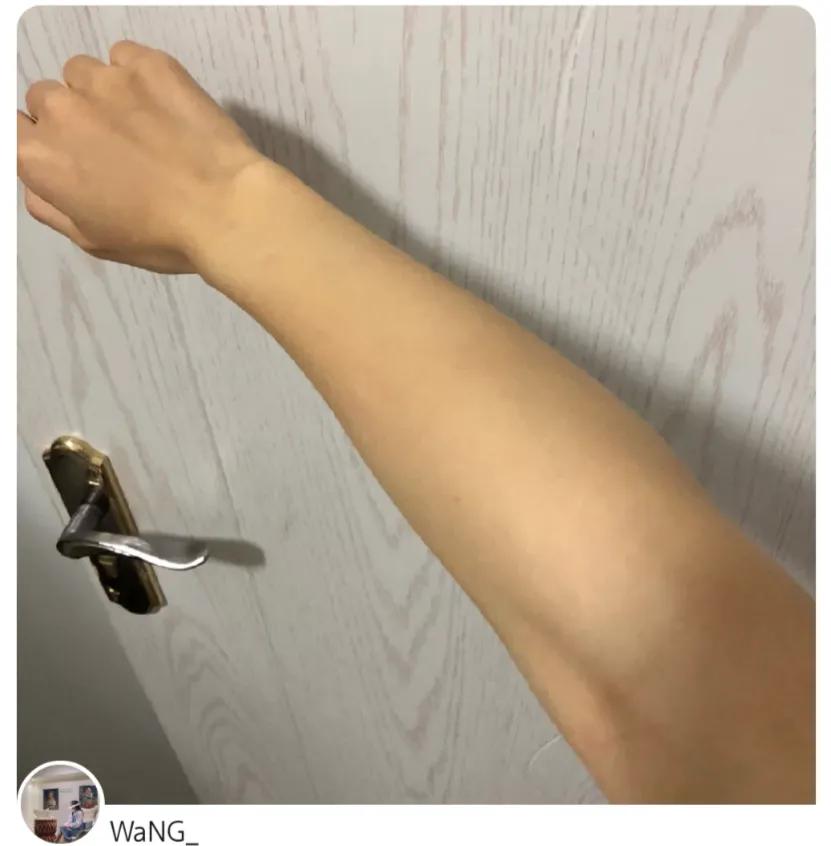 每个人的身上都有小毛毛,每个人的身上都有毛毛没有腿毛吗