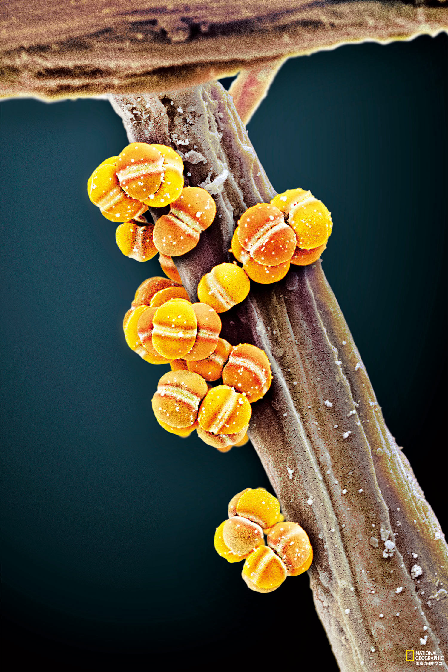 数以兆计的微生物把我们的身体当做家，你了解它们么？