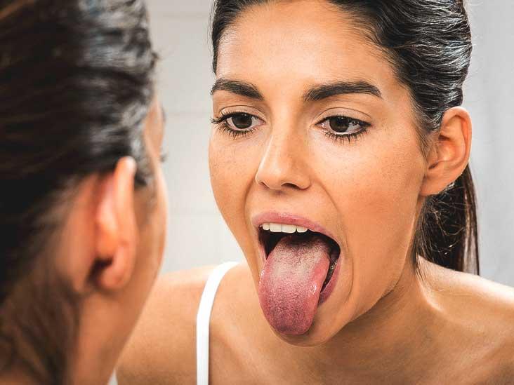 嘴巴内壁里有白色条纹是什么情况,嘴巴内壁长了白色长条是什么