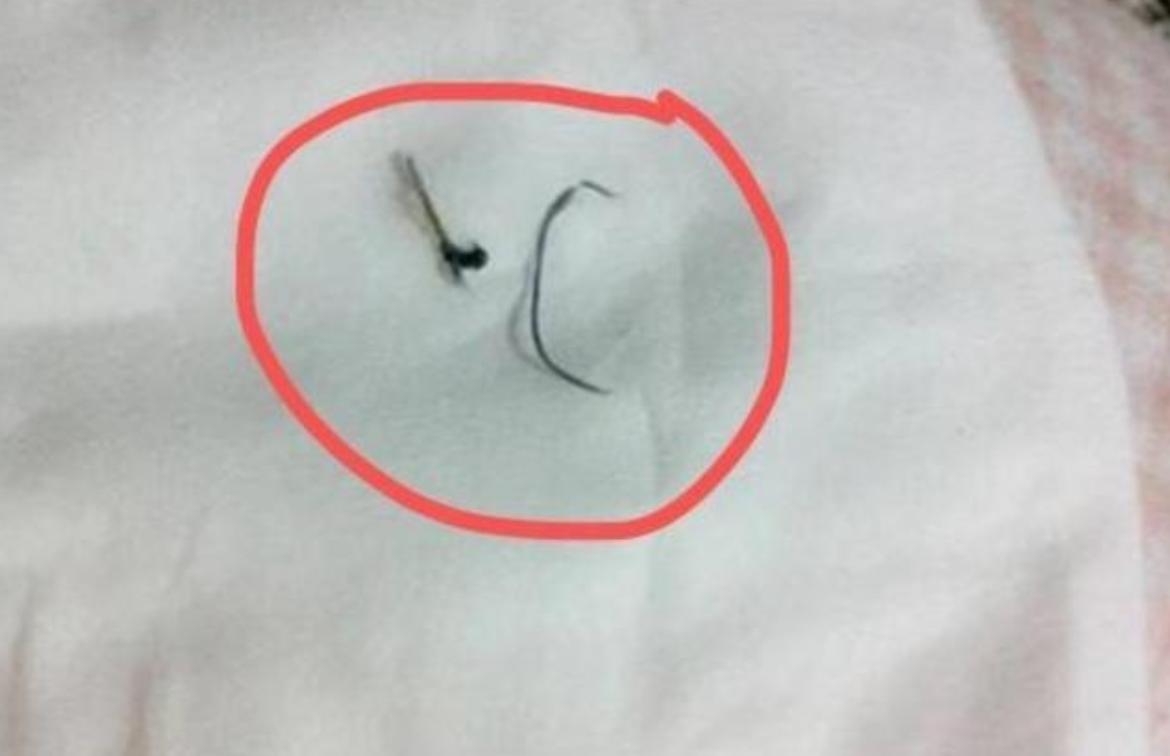 “妈妈，我的脚进虫子了”，宝妈赶紧上医院，医生：还好来得早