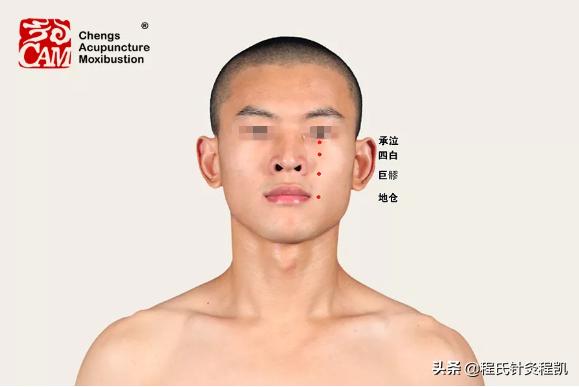 面神经炎中医诊断,面神经炎中医名称