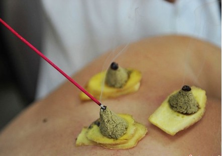 艾灸感到热和疼,艾灸时感觉很舒服