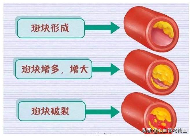 速效救心丸和丹参滴丸哪个功效好,速效救心丸和丹参滴丸哪个更好用