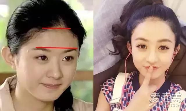 后面的发际线特别低适合什么发型,发际线太低留什么刘海