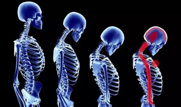 颈部受凉疼痛怎么解决,受凉引起的脖子痛怎么办