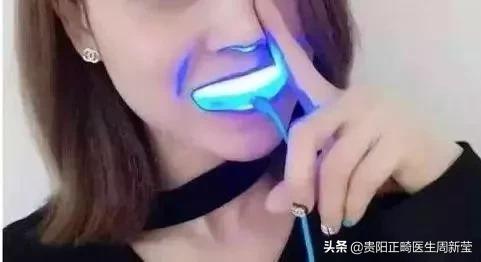 冷光美牙仪的危害,朋友圈冷光美牙仪